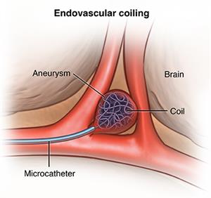 PCardio_20140127_v1_001 PCardio_20140127_v1_001