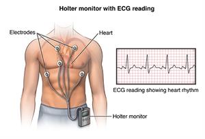 PCardio_20140402_v0_005