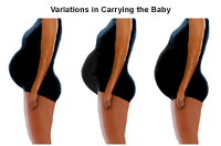 Illustration demonstrating the variations of carrying an unborn baby