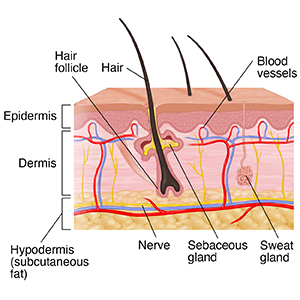 Cross section of skin showing epidermis, dermis and fat layer.