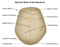 Anatomy of the normal skull of a newborn