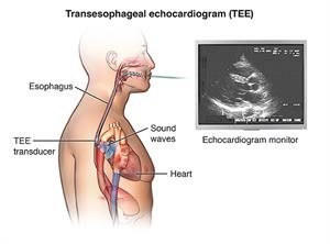 PCardio_20140402_v0_003 PCardio_20140402_v0_003