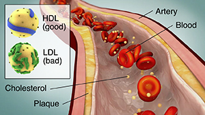 cholesterol illustration