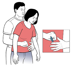 Man standing behind woman with arms around her waist. Inset shows his fist next to her upper abdomen and his other hand flattened and ready to cover his fist.